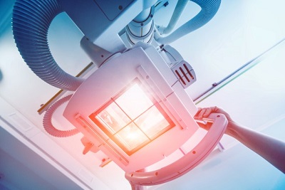 Les moyens de diagnostic en oncologie pédiatrique : Radio-isotope